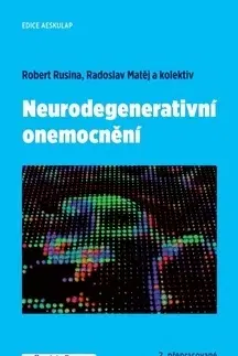 Medicína - ostatné Neurodegenerativní onemocnění - Robert Rusina,Matěj Radoslav,Kolektív autorov