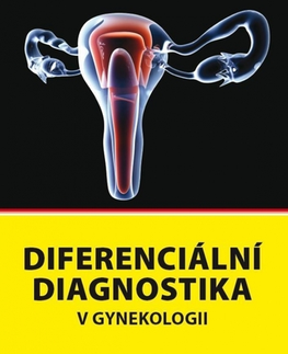 Gynekológia a pôrodníctvo Diferenciální diagnostika v gynekologii - Pavel Cepicky