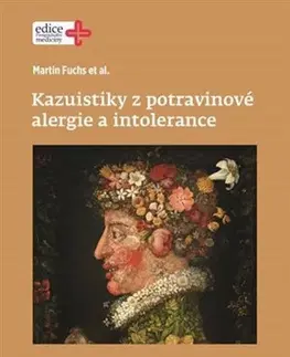 Medicína - ostatné Kazuistiky z potravinové alergie a intolerance - Martin Fuchs