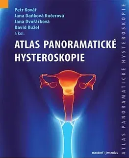 Medicína - ostatné Atlas panoramatické hysteroskopie - Kolektív autorov