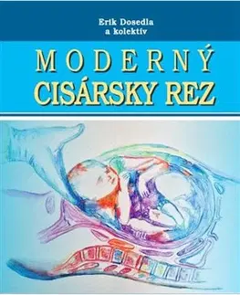 Gynekológia a pôrodníctvo Moderný cisársky rez + CD - Kolektív autorov,Erik Dosedla