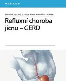 Medicína - ostatné Refluxní choroba jícnu - GERD - Kolektív autorov