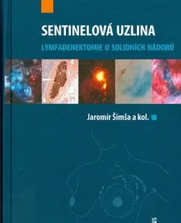 Medicína - ostatné Sentinelová uzlina - Kolektív autorov,Jaromír Šimša