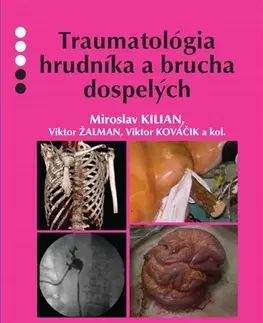Chirurgia, ortopédia, traumatológia Traumatológia hrudníka a brucha dospelých - Kilian Miroslav,Kolektív autorov