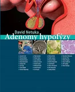 Medicína - ostatné Adenomy hypofýzy - David Netuka