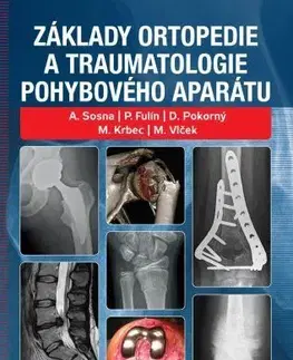 Chirurgia, ortopédia, traumatológia Základy ortopedie a traumatologie pohybového aparátu - Kolektív autorov