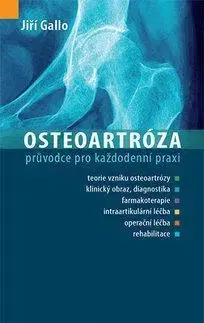 Medicína - ostatné Osteoartróza - Jiří Gallo