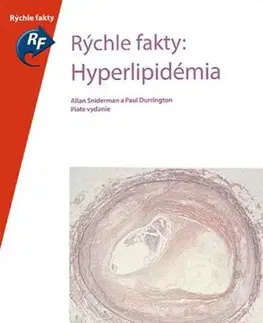 Medicína - ostatné Rýchle fakty: Hyperlipidémia - Kolektív autorov