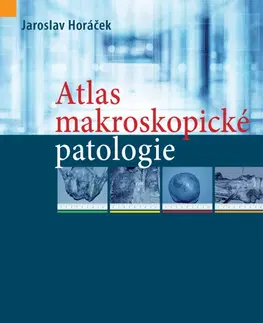 Patológia Atlas makroskopické patologie - Jaroslav Horáček
