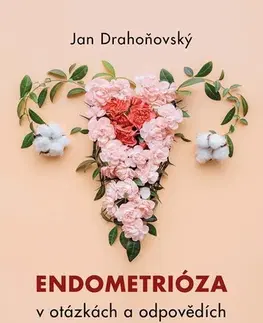 Gynekológia a pôrodníctvo Endometrióza v otázkách a odpovědích - Jan Drahoňovský