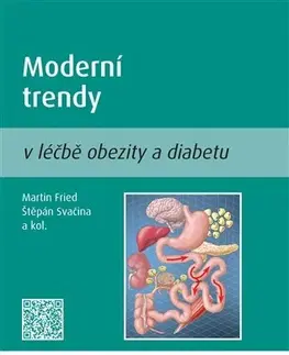 Medicína - ostatné Moderní trendy v léčbě obezity a diabetu - Fried Martin,Štěpán Svačina