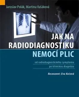 Medicína - ostatné Jak na radiodiagnostiku nemocí plic - Jaroslav Polák,Martina Vašáková