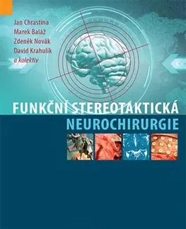 Medicína - ostatné Funkční stereotaktická neurochirurgie - Kolektív autorov