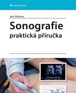 Medicína - ostatné Sonografie - praktická příručka - Jens Niehaus