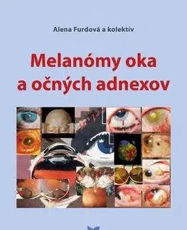 Medicína - ostatné Melanómy oka a očných adnexov - Kolektív autorov,Alena Furdová