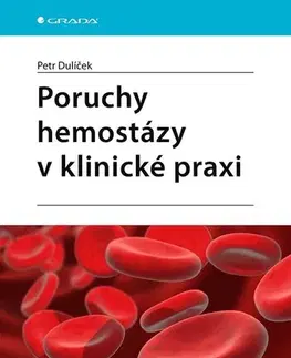 Medicína - ostatné Poruchy hemostázy v klinické praxi - Petr Dulíček