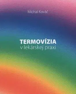 Medicína - ostatné Termovízia v lekárskej praxi - Michal Kováč