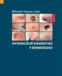 Medicína - ostatné Diferenciální diagnostika v dermatologii - Miloslav Salavec