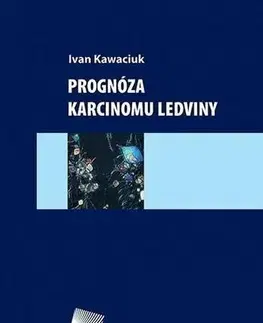Medicína - ostatné Prognóza karcinomu ledviny - Ivan Kawaciuk