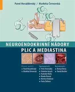 Medicína - ostatné Neuroendokrinní nádory plic a mediastina - Pavel Horažďovský