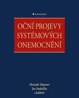 Medicína - ostatné Oční projevy systémových onemocnění - Alexandr Stěpanov,Jan Studnička,Kolektív autorov