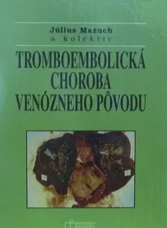 Medicína - ostatné Tromboembolická choroba venózneho pôvodu - Kolektív autorov,Július Mazúch