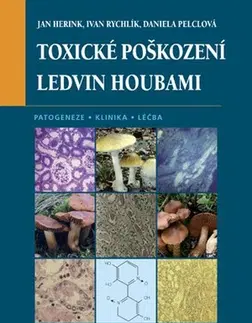 Medicína - ostatné Toxické poškození ledvin houbami - Jan Herink,Ivan Rýchlik,Daniela Pelclová