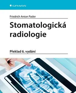 Stomatológia Stomatologická radiologie (Překlad 6. vydání) - Pasler A. Friedrich