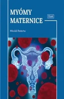 Gynekológia a pôrodníctvo Myómy maternice - Mikuláš Redecha