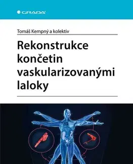Chirurgia, ortopédia, traumatológia Rekonstrukce končetin vaskularizovanými laloky - Tomáš Kempný,Kolektív autorov