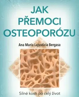 Zdravoveda, ochorenia, choroby Jak přemoci osteoporózu - Anna Maria Lajusticia Bergasa