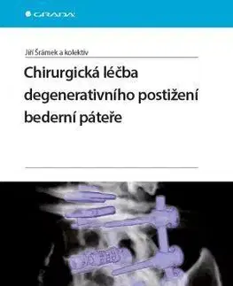 Chirurgia, ortopédia, traumatológia Chirurgická léčba degenerativního postižení bederní páteře - Kolektív autorov,Jiří Šrámek