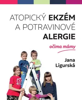 Alternatívna medicína - ostatné Atopický ekzém a potravinové alergie očima mámy - Jana Ligurská