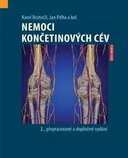 Anatómia Nemoci končetinových cév (2. přepracované a doplněné vydání) - Karel Roztočil,Jan Piťha