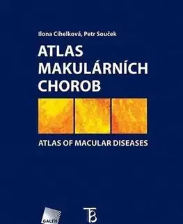 Medicína - ostatné Atlas makulárních chorob - I. Cihelková,P. Souček