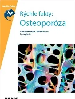 Medicína - ostatné Rýchle fakty: Osteoporóza - Kolektív autorov