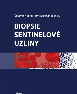 Medicína - ostatné Biopsie sentinelové uzliny - Čestmír Neoral,Tomáš Bohanes a kolektív