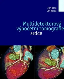 Medicína - ostatné Multidetektorová výpočetní tomografie srdce - Jan Baxa,Jiří Ferda