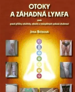 Medicína - ostatné Otoky a záhadná lymfa (Nové, upravené a rozšířené vydání) - Jitka Bičíková