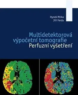 Medicína Multidetektorová výpočetní tomografie - Jiří Ferda,Hynek Mírka
