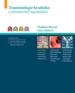 Medicína - ostatné Traumatologie hrudníku v instruktivních kazuistikách - Vladislav Hytych,Alice Tašková