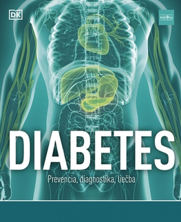 Medicína - ostatné Diabetes: Prevencia, diagnostika, liečba - Rosemary Walker,Zora Ličková