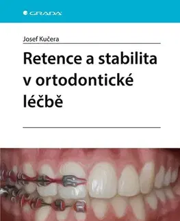 Stomatológia Retence a stabilita v ortodontické léčbě - Josef Kučera