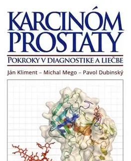 Onkológia Karcinóm prostaty - Ján Kliment,Michal Mego,Pavol Dubinský