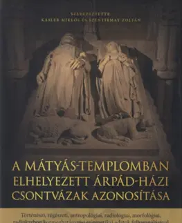 Archeológia, genealógia a heraldika A Mátyás-templomban elhelyezett Árpád-házi csontvázak azonosítása - Kolektív autorov