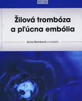 Medicína - ostatné Žilová trombóza a pľúcna embólia - Anna Remková,Kolektív autorov
