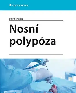 Medicína Nosní polypóza - Petr Schalek
