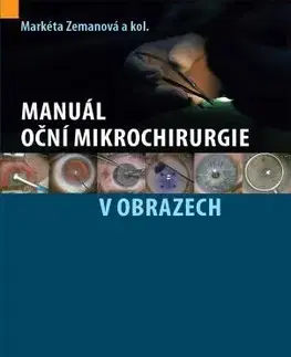 Chirurgia, ortopédia, traumatológia Manuál oční mikrochirurgie v obrazech - Markéta Zemanová