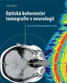Medicína - ostatné Optická koherenční tomografie v neurologii - Kolektív autorov,Jana Lízrová Preiningerová