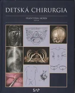 Pediatria Detská chirurgia - František Horn